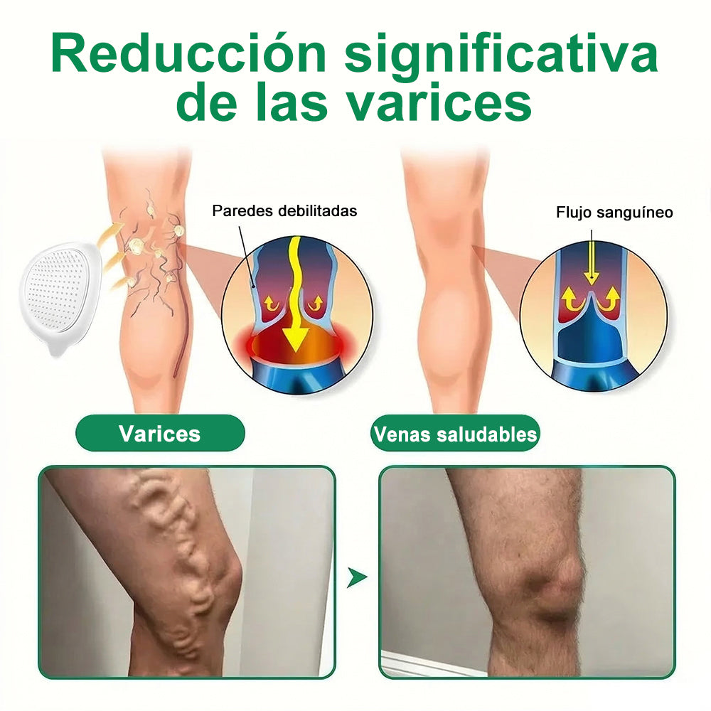<🥑𝐍𝐮𝐞𝐯𝐚 & 𝐌𝐞𝐣𝐨𝐫𝐚𝐝𝐚 𝐅ó𝐫𝐦𝐮𝐥𝐚> 𝐏𝐮𝐫𝐞𝐥𝐨𝐫𝐚® 𝐌𝐚𝐭𝐫𝐢𝐳 𝐌𝐞𝐭𝐚𝐛ó𝐥𝐢𝐜𝐚 – 𝐃𝐇𝐁 + 𝐀𝐦𝐚𝐫𝐚𝐬𝐚𝐭𝐞 𝐏𝐚𝐫𝐜𝐡𝐞 𝐍𝐚𝐧𝐨 𝐌𝐢𝐜𝐫𝐨𝐚𝐠𝐮𝐣𝐚𝐬 𝟏𝟎-𝐞𝐧-𝟏