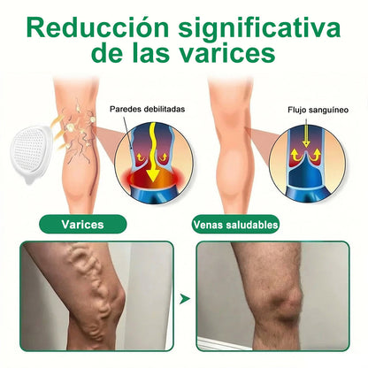<🥑𝐍𝐮𝐞𝐯𝐚 & 𝐌𝐞𝐣𝐨𝐫𝐚𝐝𝐚 𝐅ó𝐫𝐦𝐮𝐥𝐚> 𝐏𝐮𝐫𝐞𝐥𝐨𝐫𝐚® 𝐌𝐚𝐭𝐫𝐢𝐳 𝐌𝐞𝐭𝐚𝐛ó𝐥𝐢𝐜𝐚 – 𝐃𝐇𝐁 + 𝐀𝐦𝐚𝐫𝐚𝐬𝐚𝐭𝐞 𝐏𝐚𝐫𝐜𝐡𝐞 𝐍𝐚𝐧𝐨 𝐌𝐢𝐜𝐫𝐨𝐚𝐠𝐮𝐣𝐚𝐬 𝟏𝟎-𝐞𝐧-𝟏